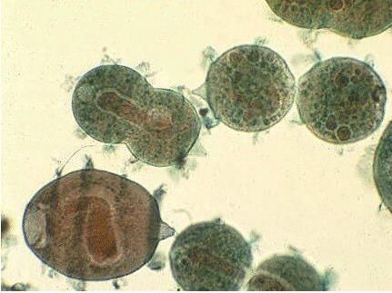 废水中重金属污、微生物污染物的处理方法